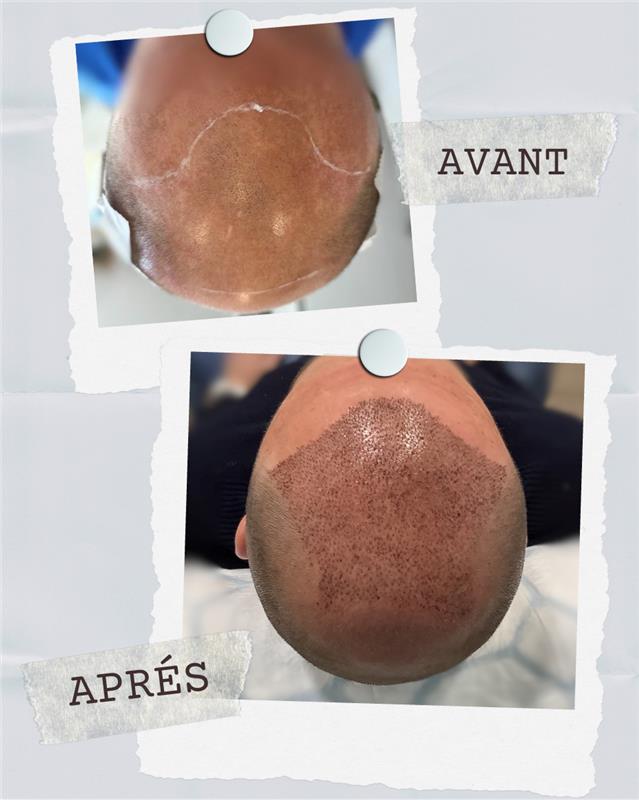 Photo à remplacer